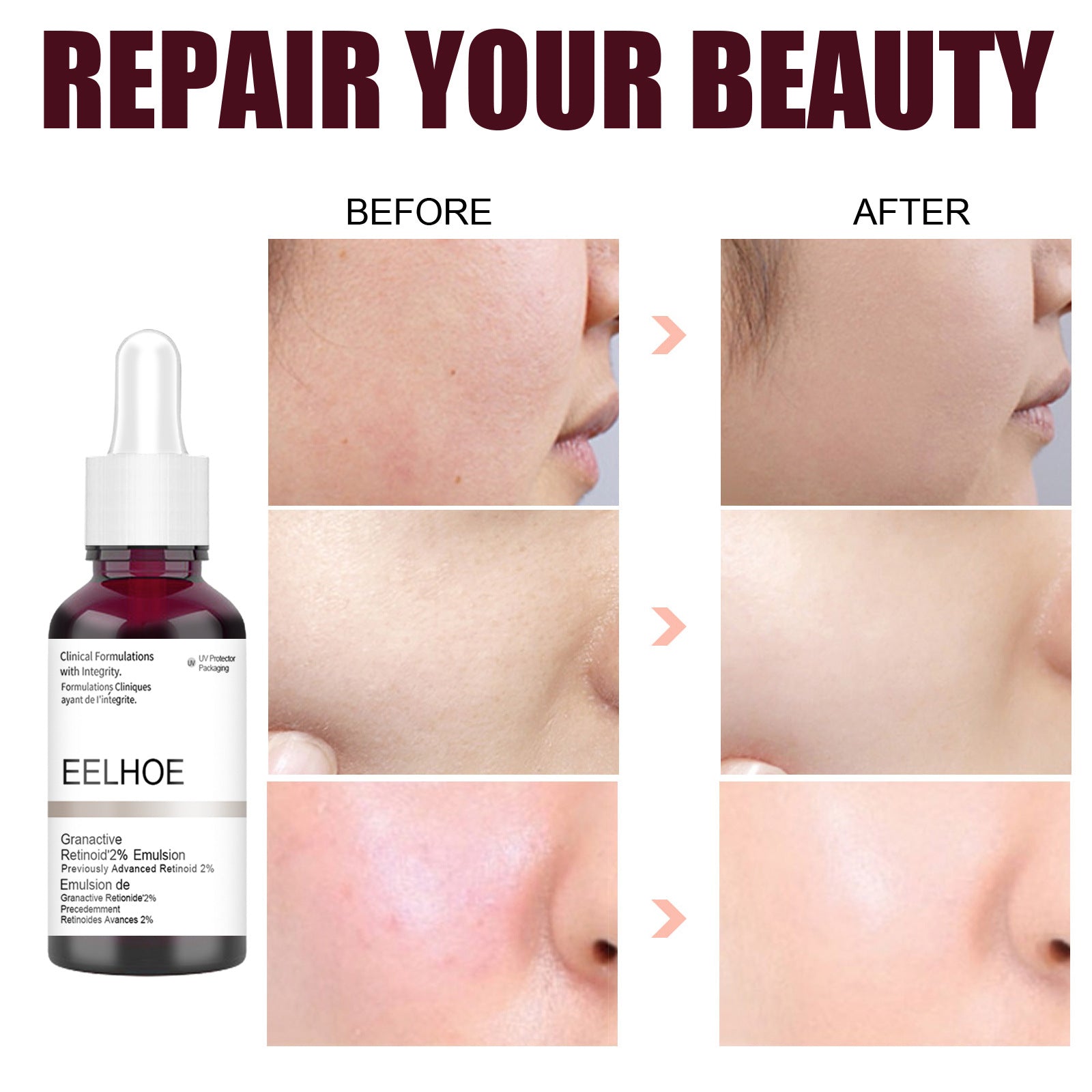 Salicylic Acid Moisturizing Gentle Care Smoothing Pore Refining Serum
